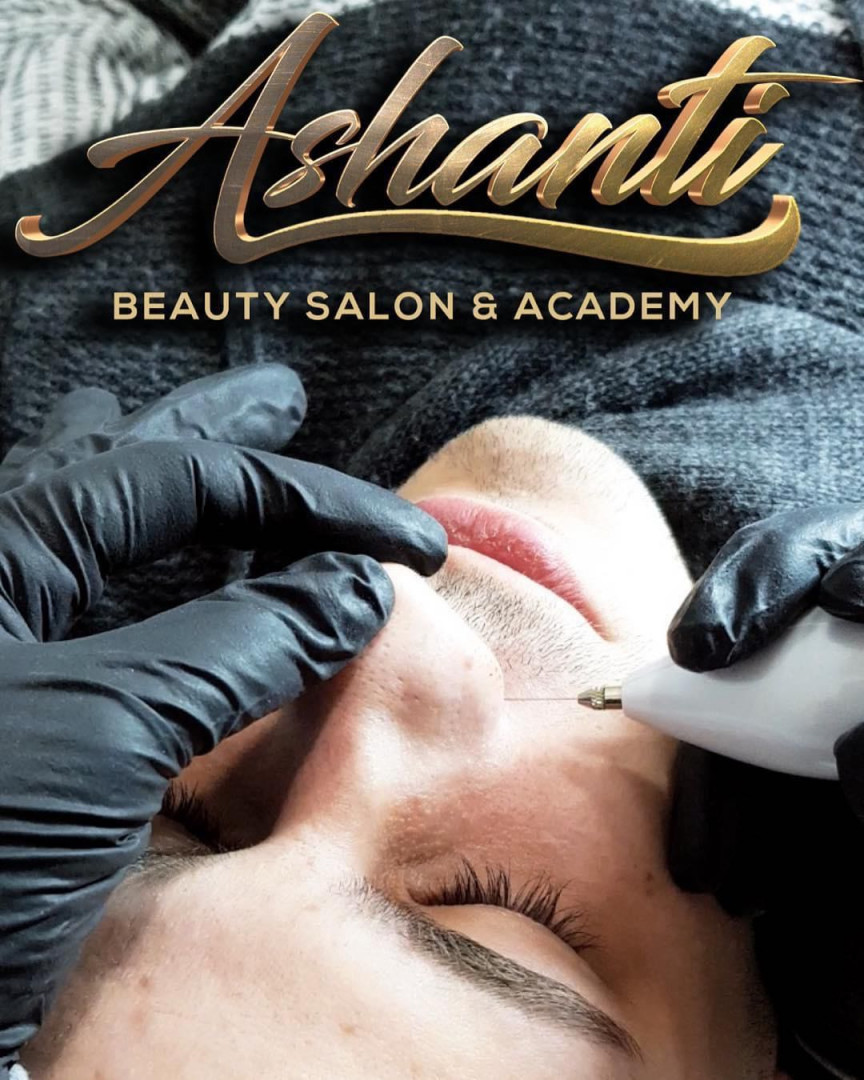 Plasma pen - podizanje nosa - Ashanti Beauty Salon & Academy, Beograd Tretman lica Lice Tretman lica, Beograd, Voždovac