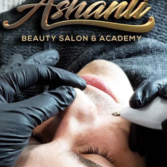 Ashanti Beauty Salon & Academy #beograd Tretman lica Plasma pen - podizanje nosa