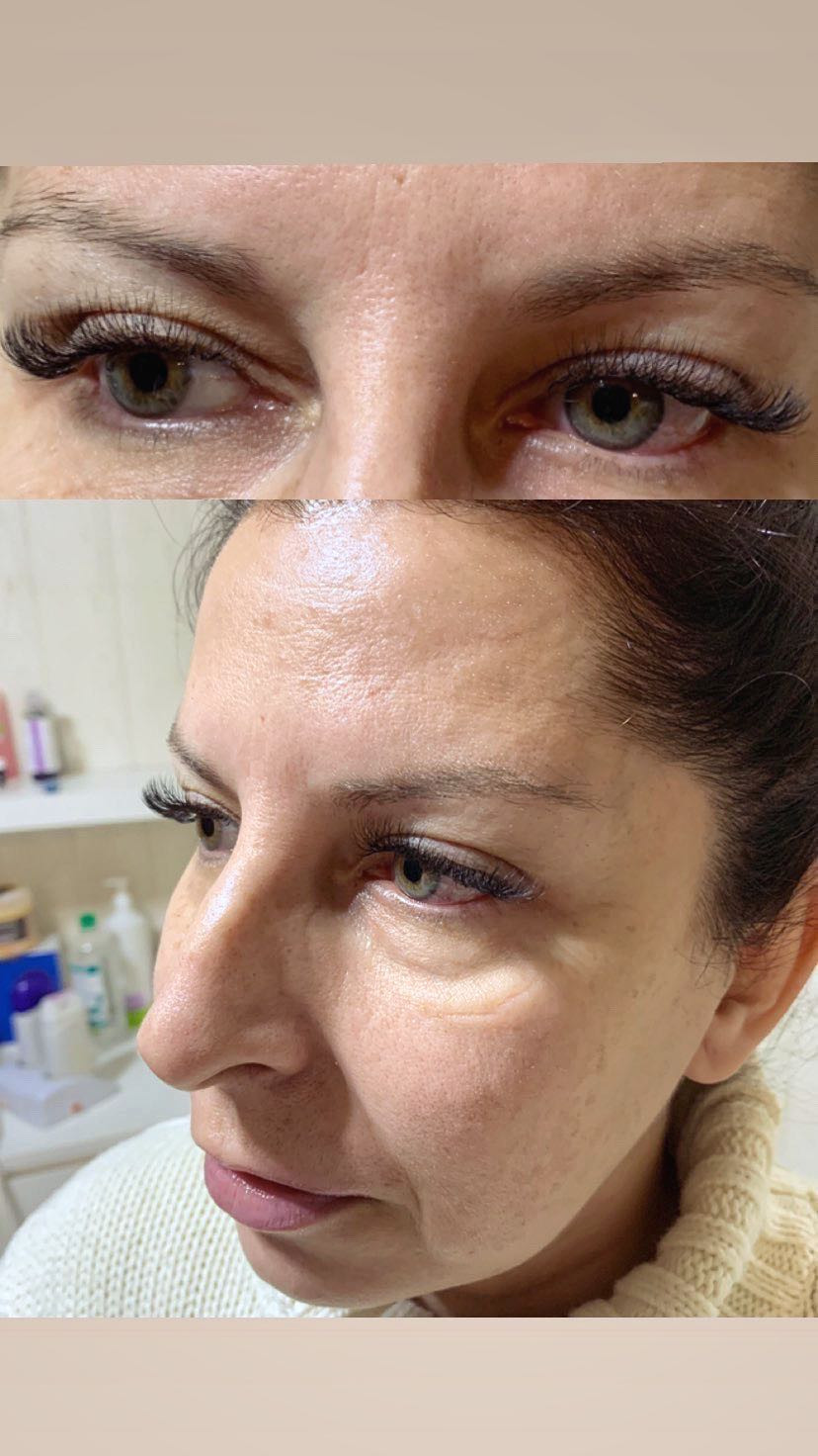 Monami beauty #beograd Nadogradnja trepavica Svilene trepavice - 1 na 1