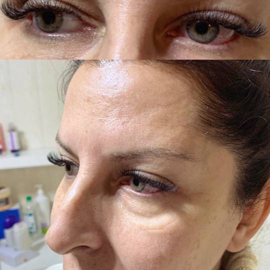 Monami beauty #beograd Nadogradnja trepavica Svilene trepavice - 1 na 1