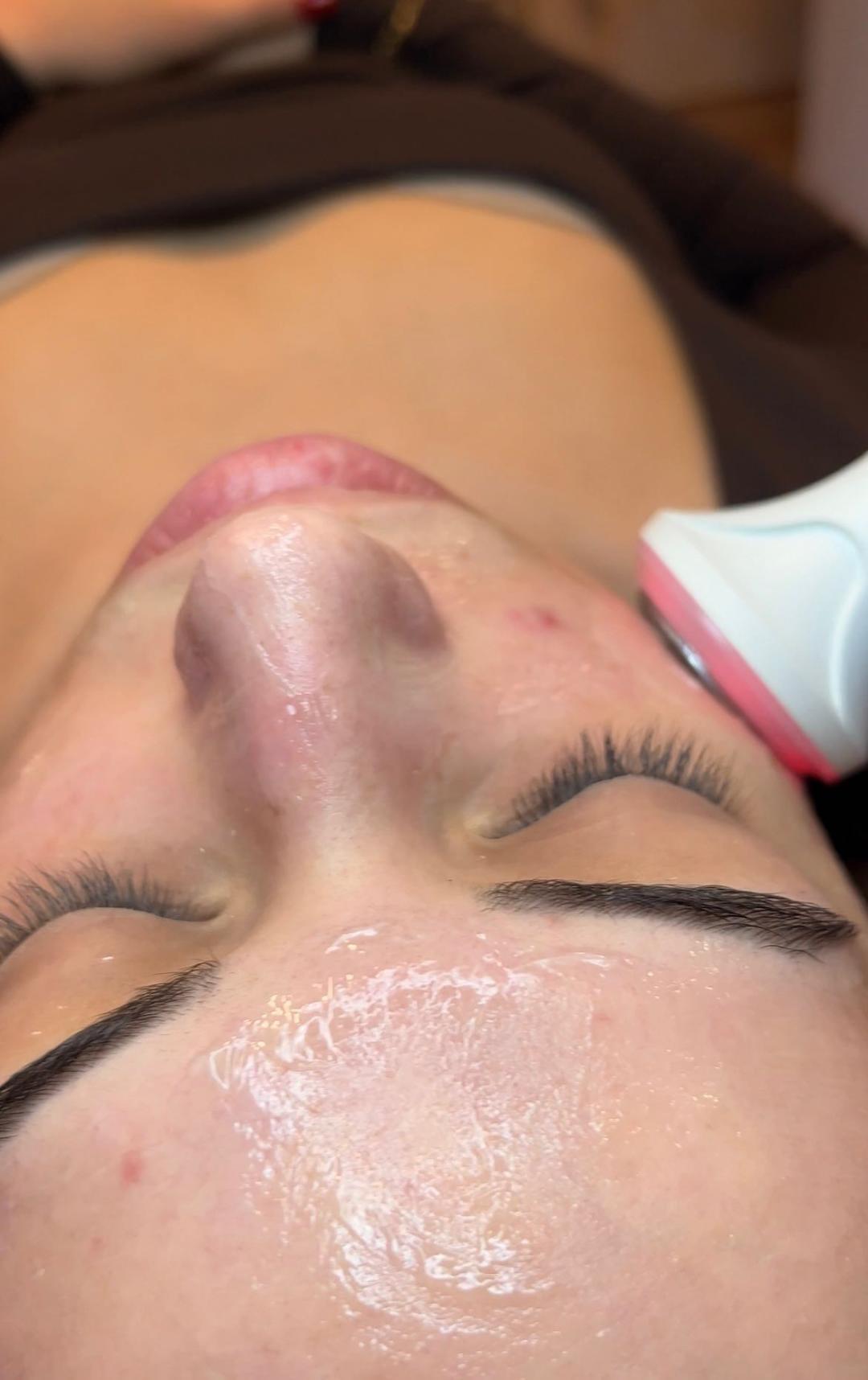 HydraGlow Facial - Hidrafacial tretman lica - Esthetique Privé, Beograd Tretman lica Lice Tretman lica, Beograd, Centar, Stari grad, Dorćol