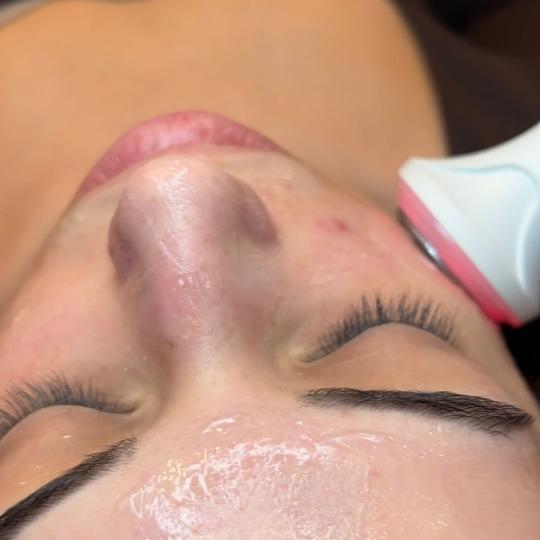 Esthetique Privé #beograd Tretman lica HydraGlow Facial - Hidrafacial tretman lica