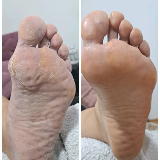 Beauty Studio by Milica Pavlović #beograd Estetski pedikir Pedikir sa profi diskom Ruski pedikir s
