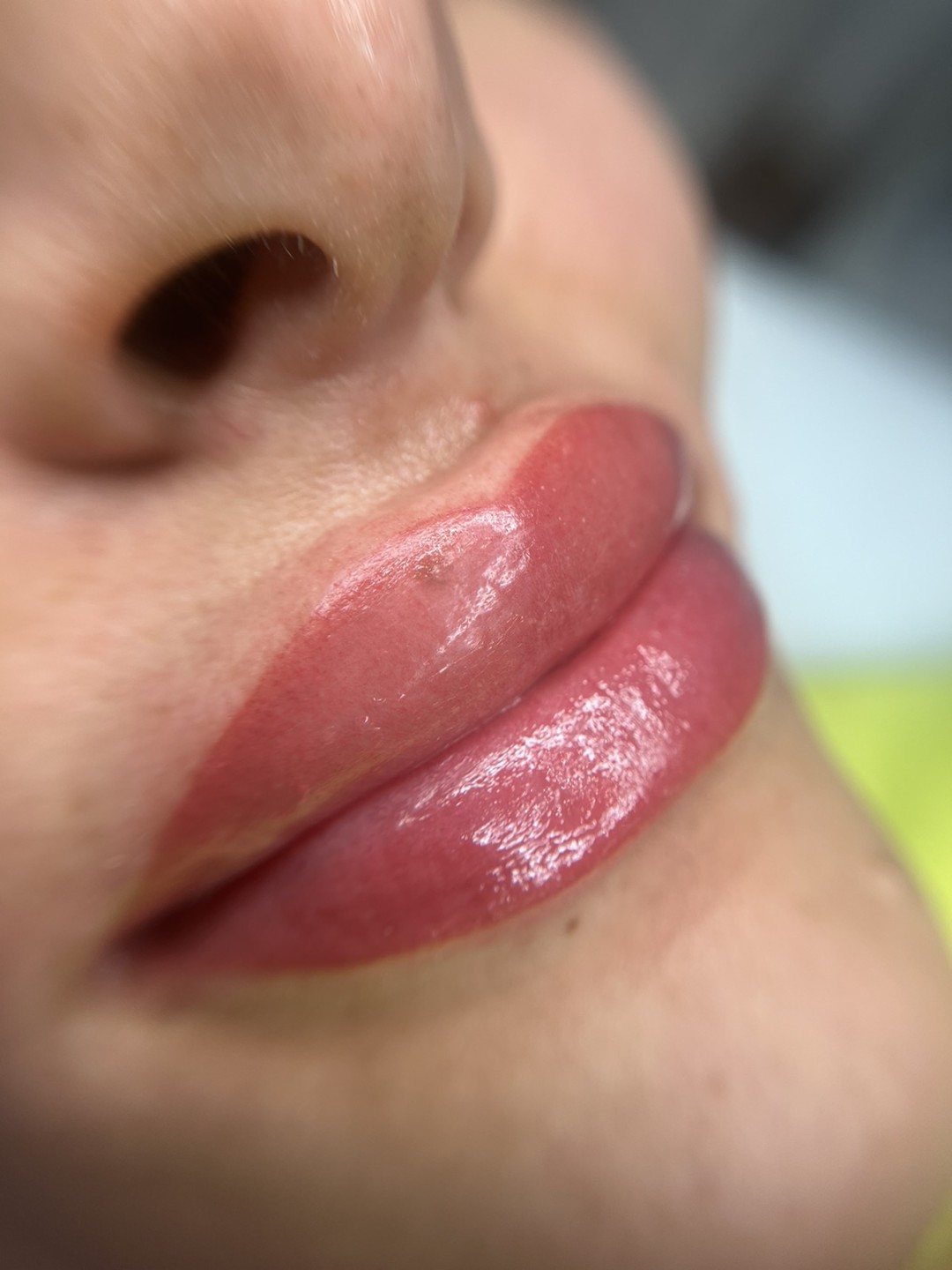 Esthetique Privé #beograd Trajna šminka Trajna šminka usana - PHILIPPS