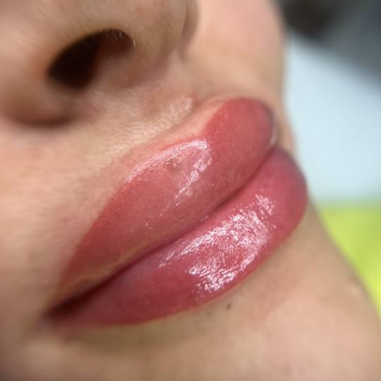 Esthetique Privé #beograd Trajna šminka Trajna šminka usana - PHILIPPS
