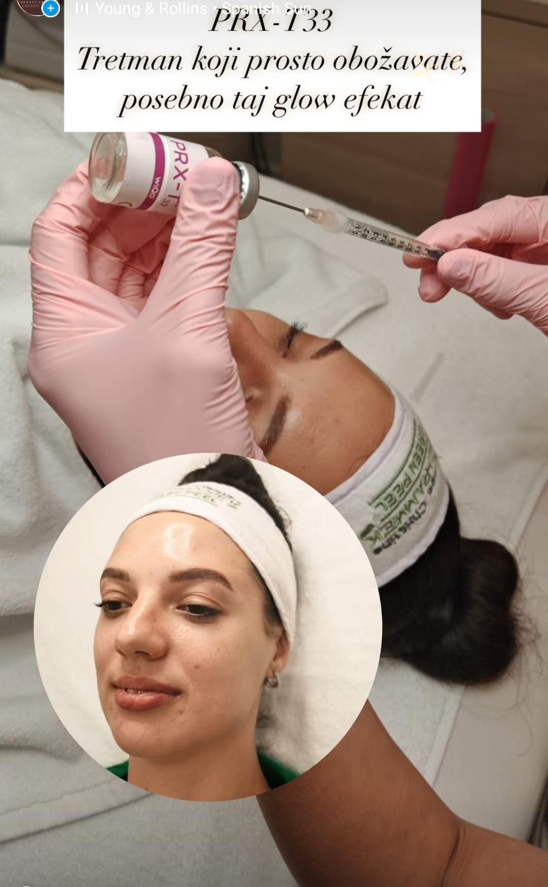 Choco Love #beograd Tretman lica PRX therapy