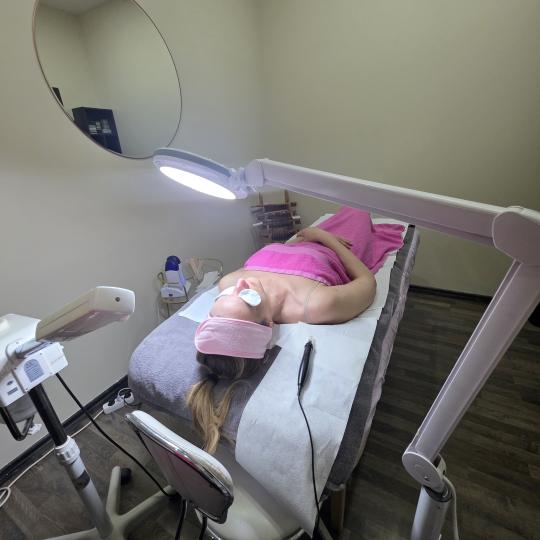 Starmedic #beograd Dermaroler i dermapen Dermapen tretman lica