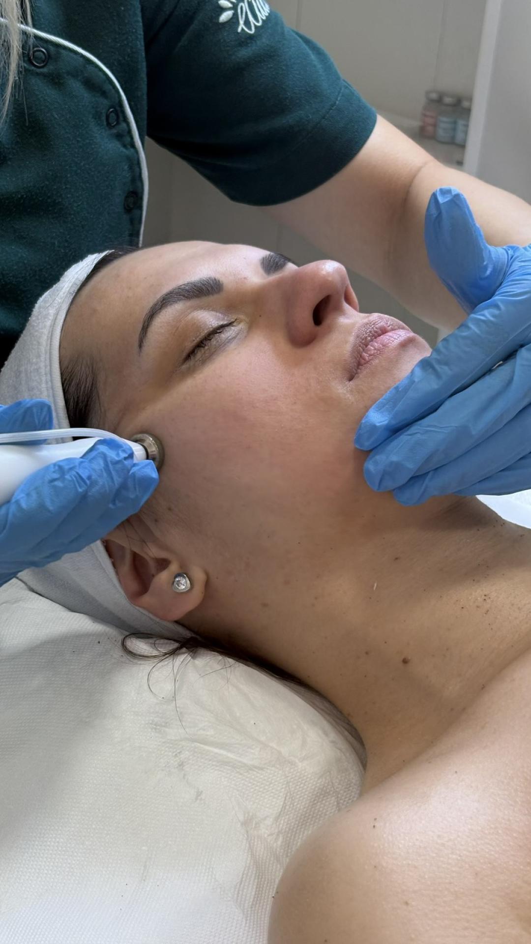 Estetik MPL 87 #beograd