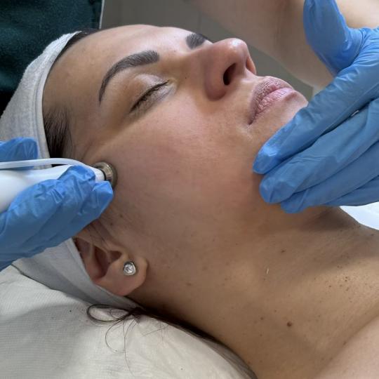 Estetik MPL 87 #beograd