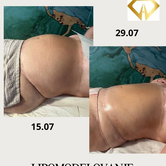 Beauty and nutrition usluga