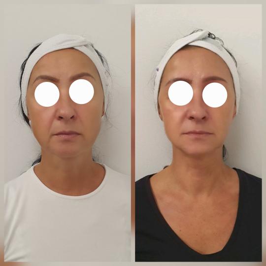 Beauty Vreme za mene usluga