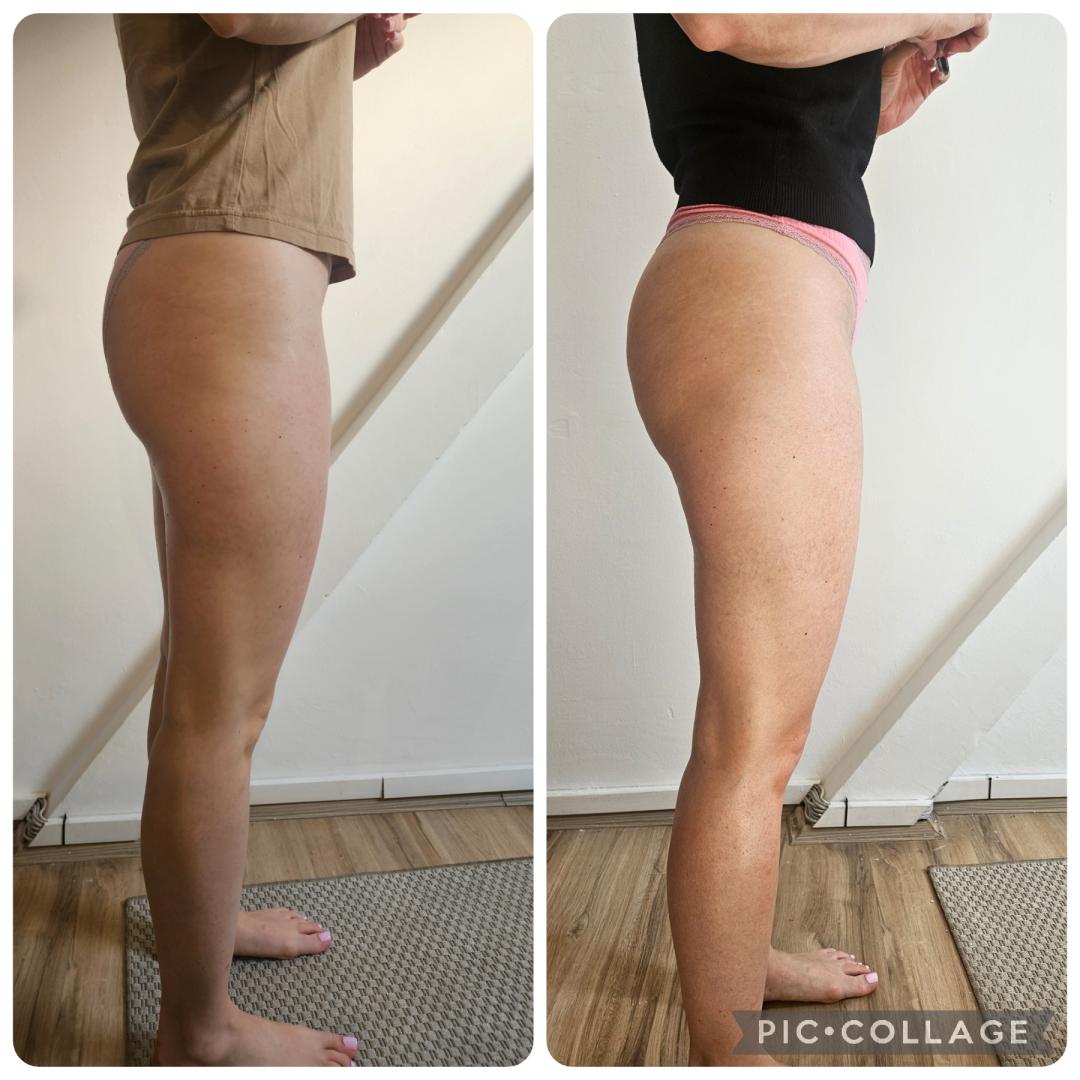 Leonis Beauty Premium #beograd Anticelulit Masaža G5 aparatom