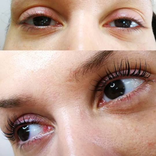 Magični dodir #beograd Trepavice Lash lift Lash lift + botox trepavica Lash Lift je tretman za prir