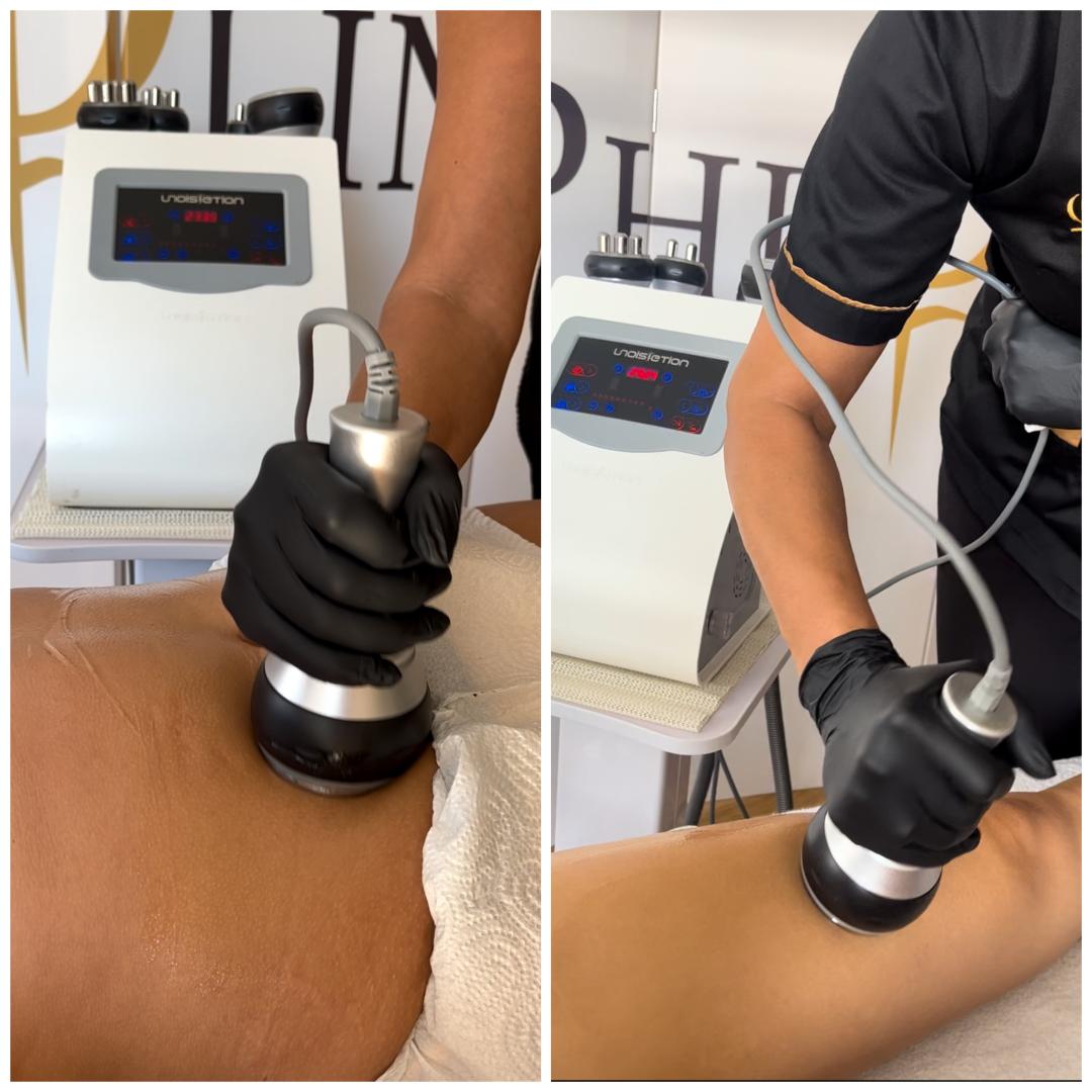 Kavitacija - stomak - Belle Ana, Beograd Kavitacija Telo Kavitacija, Beograd, Vračar, Čubura, Crveni krst