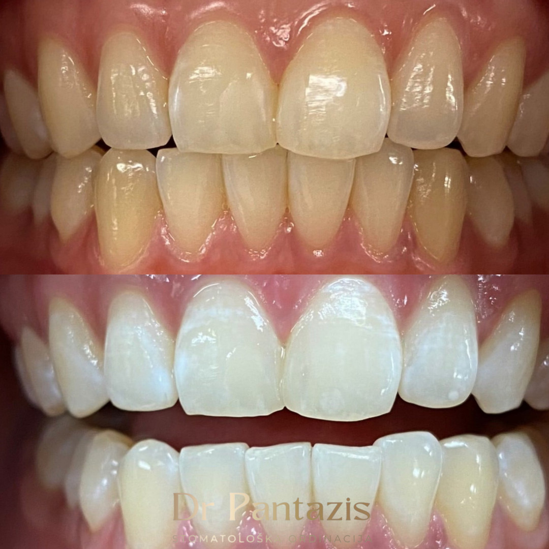 Dr Pantazis - Dental & Beauty Clinic #beograd Zubi