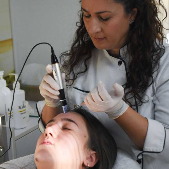 Iva Beauty Lab #beograd Tretman lica Dermapen sa hemijskim pilingom Dermapen
Dermapen je naprednija