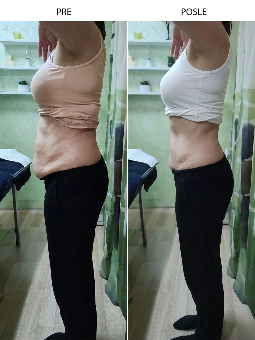 Lady 9 #beograd Kavitacija Kavitacija - po regiji