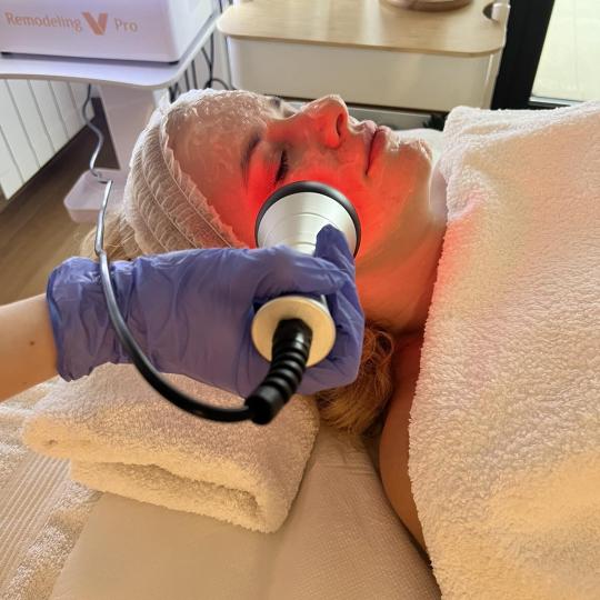 Velvet #beograd Tretman lica Raditalasni lifting - lice