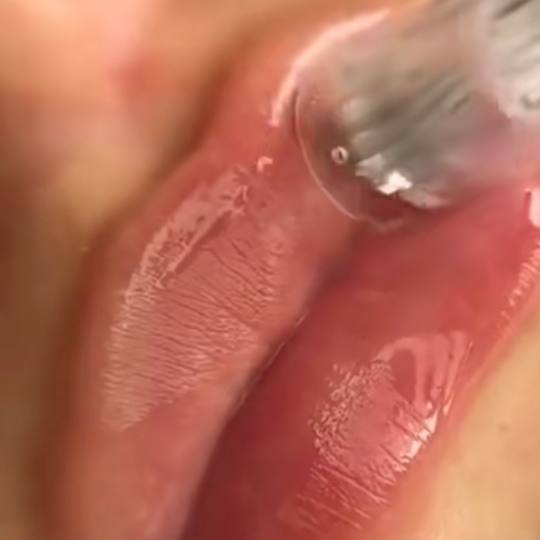 Glow Holistic Studio #beograd Tretman lica Hydra lips Hydra Lips tretman - osvežite usne neinvazivn