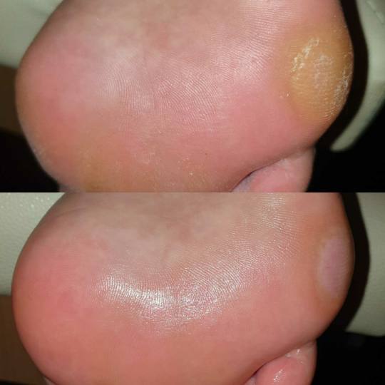 Mamey #beograd Estetski pedikir Ruski pedikir sa diskom