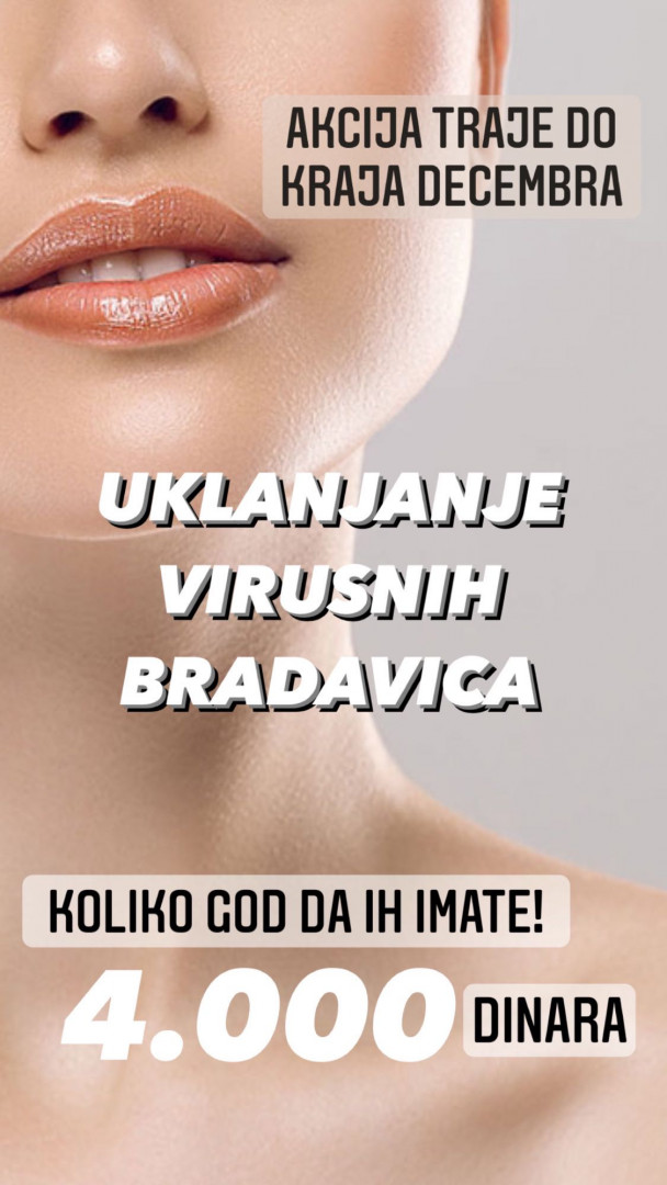 Uklanjanje virusnih bradavica - Ashanti Beauty Salon & Academy, Beograd Tretman lica Lice Tretman lica, Beograd, Voždovac