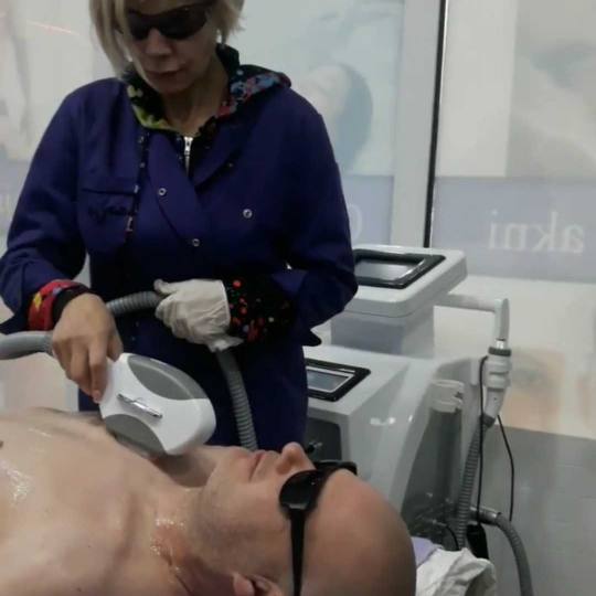 AltaBella Batajnica #beograd Laserska epilacija Laserska epilacija vrata - za muškarce