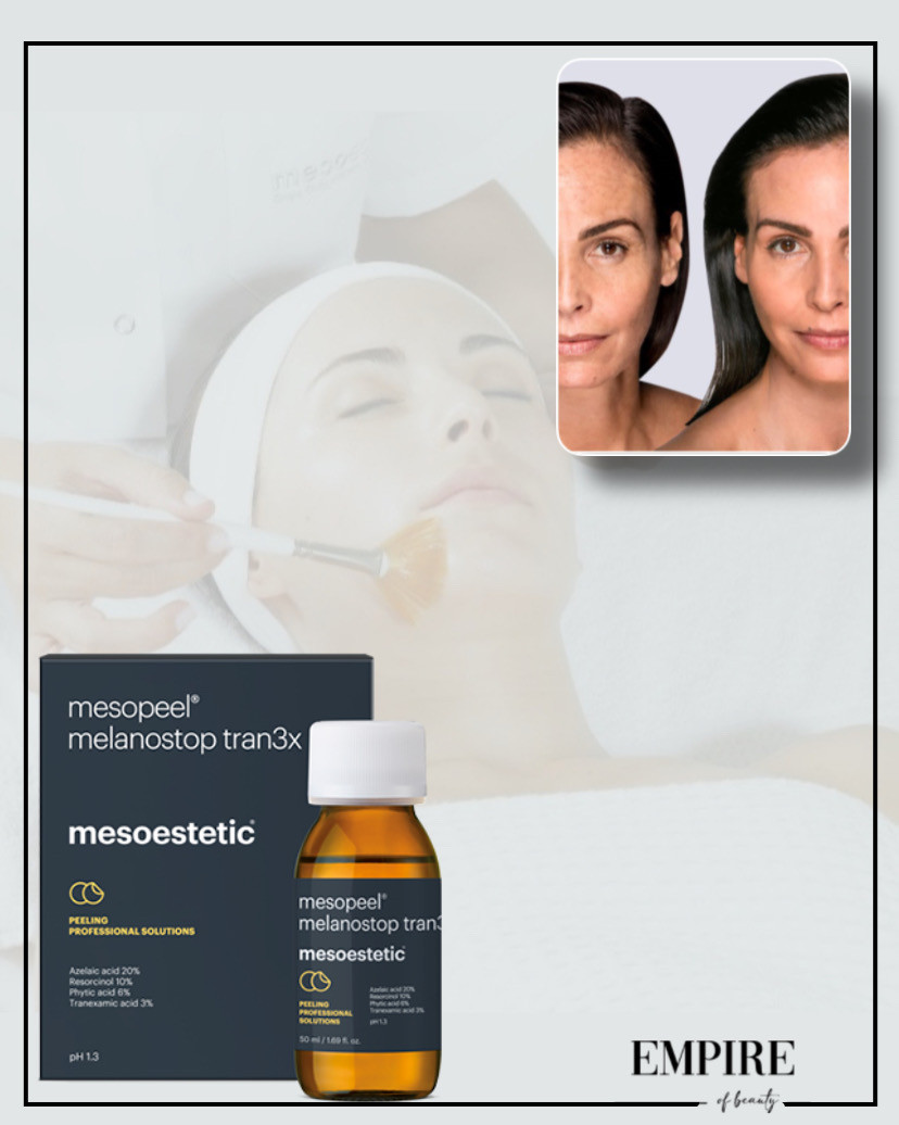Guardian Beauty Centar & Milica Tepavac #beograd Tretman lica Hemijski piling Melanostop tran3x - Mesoestetic