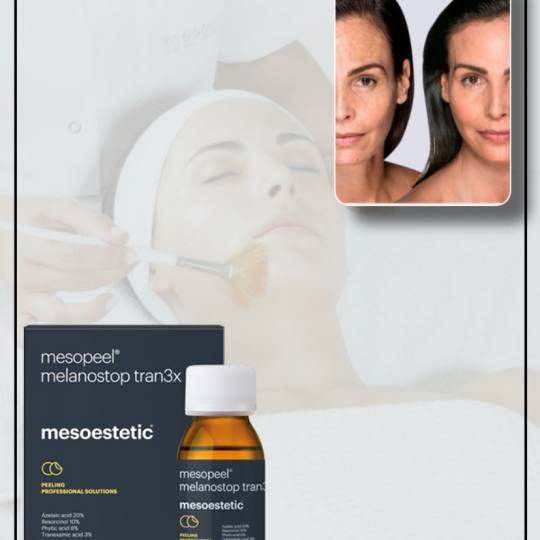 Guardian Beauty Centar & Milica Tepavac #beograd Tretman lica Hemijski piling Melanostop tran3x - Me