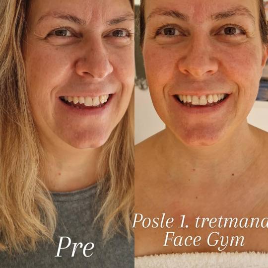 Glow Holistic Studio #beograd Masaža lica Face gym - 60 minuta Na prvom tretmanu vas očekuje:
- D