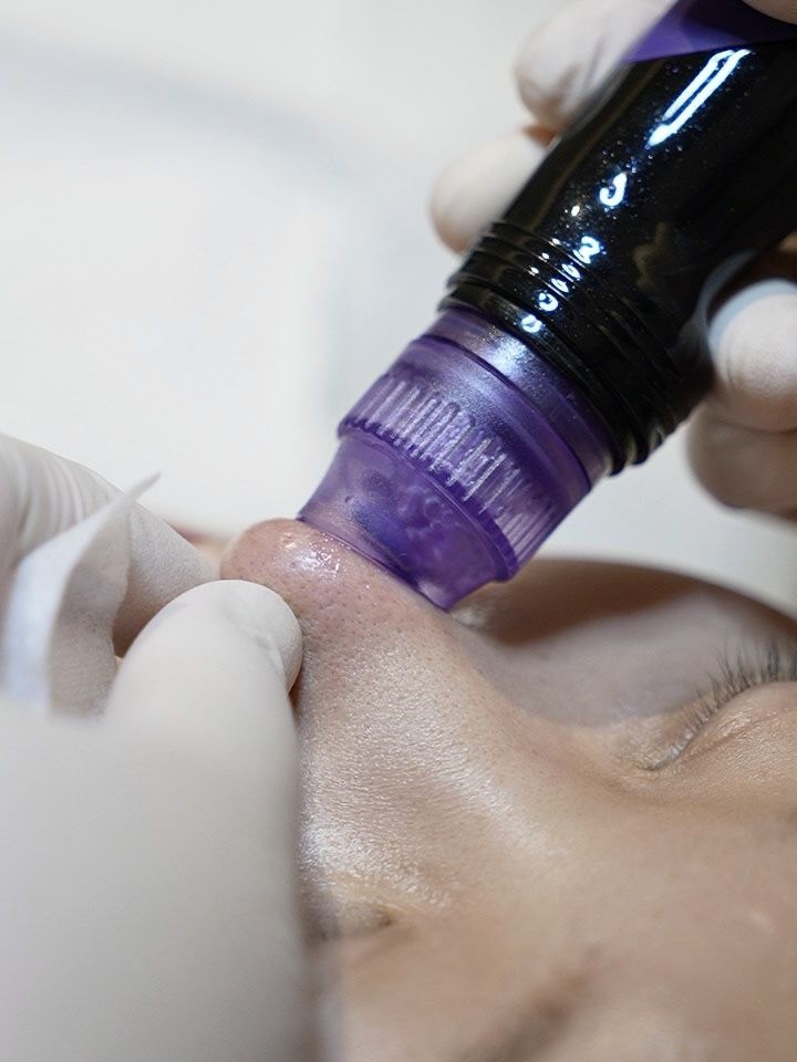 Mei by Tija Korean Beauty Salon #beograd Tretman lica Hydro swirl deep cleaning tretman