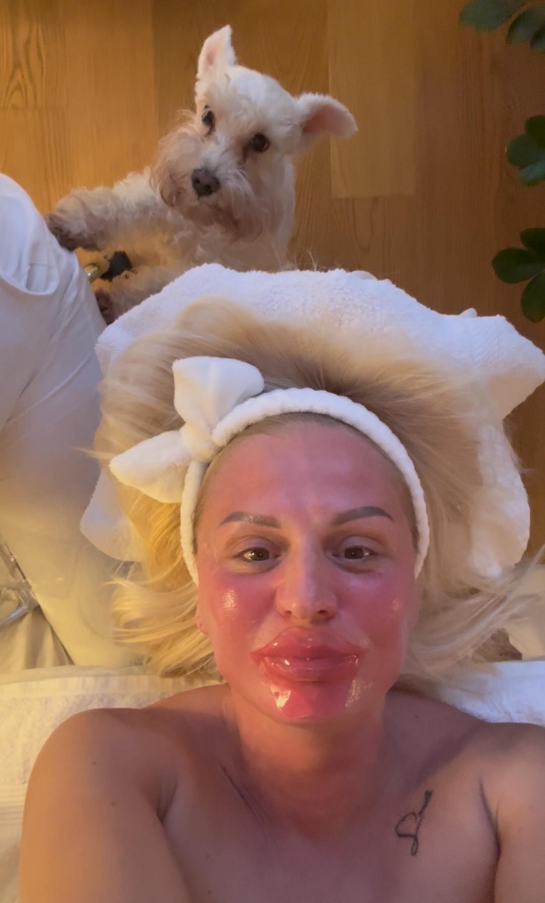 Hydra lips 30 min - Glow Holistic Studio, Beograd Tretman lica Lice Tretman lica, Beograd, Novi Beograd blokovi, Belville, Savski kej