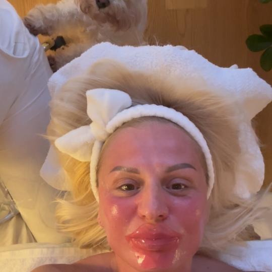 Glow Holistic Studio #beograd Tretman lica Hydra lips 30 min Hydra Lips tretman - osvežite usne nei