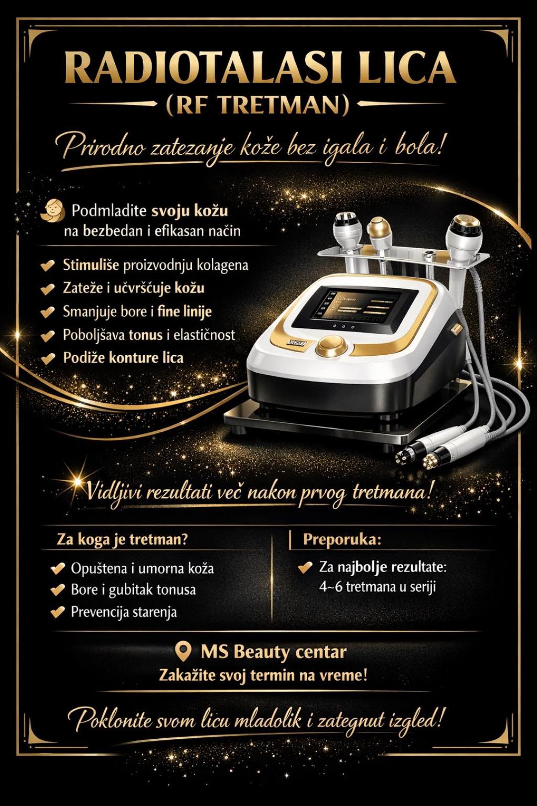 MS Beauty Centar #beograd Tretman lica Radiotalasni lifting lica