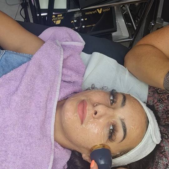 Laser centar Delight #beograd Tretman lica Oxygen tretman kiseonikom