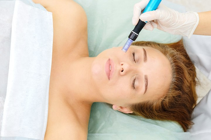 Salon Klinik #beograd Dermaroler i dermapen Dermapen