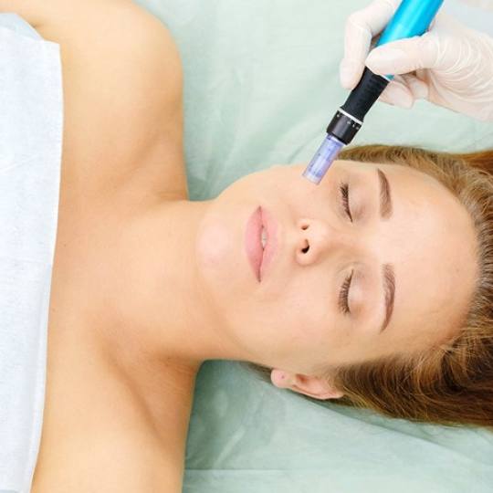 Salon Klinik #beograd Dermaroler i dermapen Dermapen Akcija, celo lice 2900 din! Nestaju bore,prosir