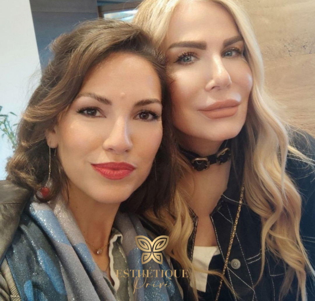 Esthetique Privé #beograd Tretman lica Hydrafacial tretman lica + čišćenje lica