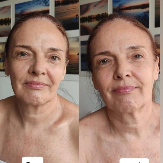 Glow Holistic Studio #beograd Tretman lica Face lifting tretman - Čišćenje lica + kolagenska mask