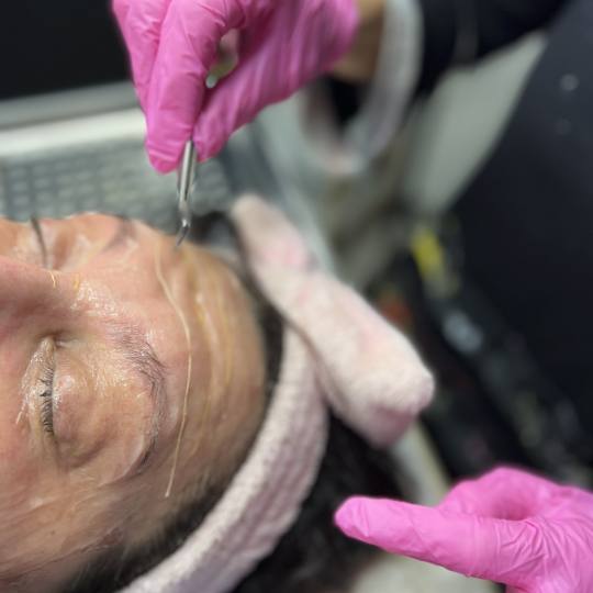 Beauty and nutrition #beograd Tretman lica Kolagen niti lice,vrat i dekolte Kolagen niti neinvazivne