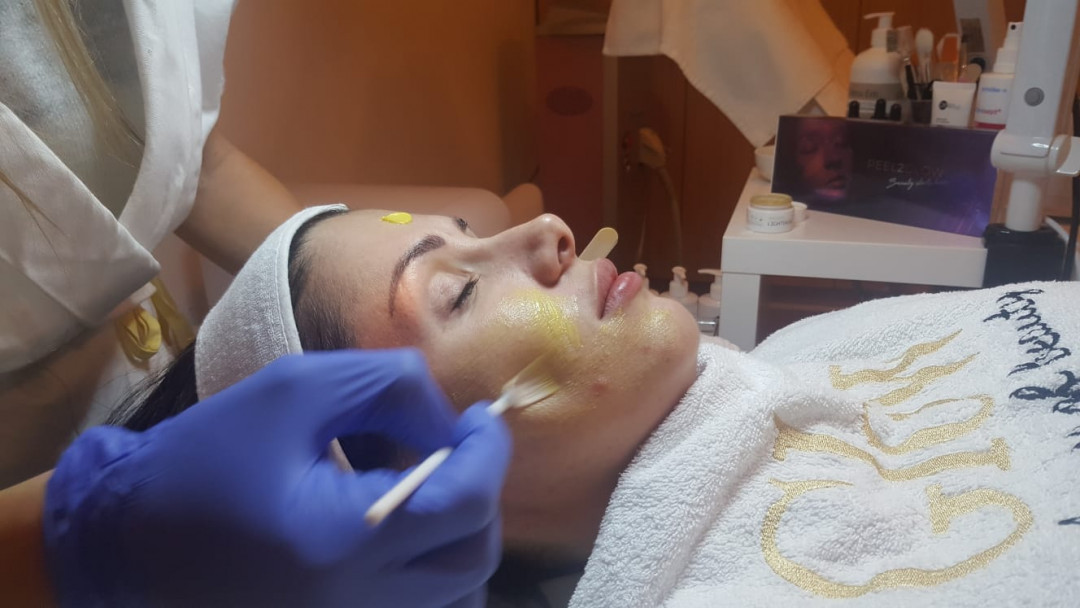 Glow beauty studio #beograd Tretman lica Retinoični piling