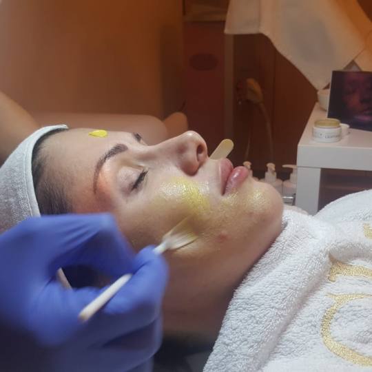 Glow beauty studio #beograd Tretman lica Retinoični piling