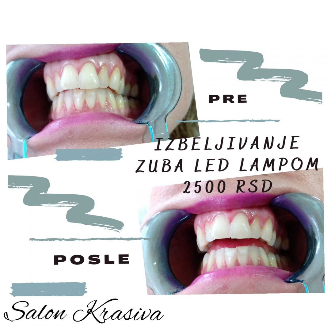 Krasiva #beograd Zubi