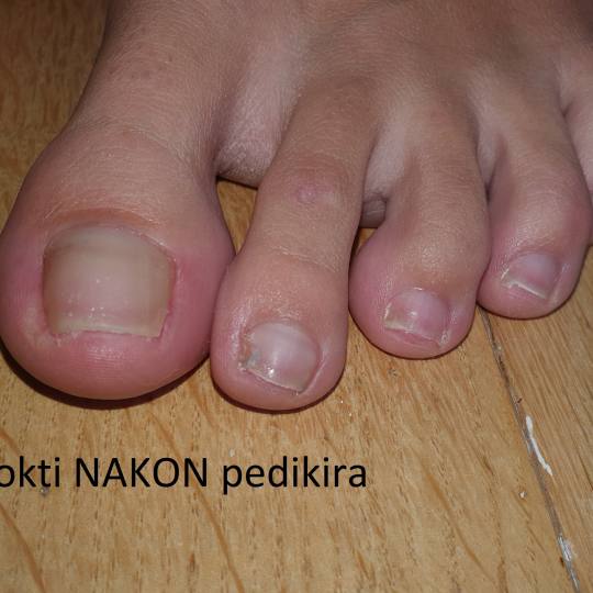Mint #beograd Medicinski pedikir Ja smatram da je najbolje da ovaj salon ne nudi uslugu pedikira i m