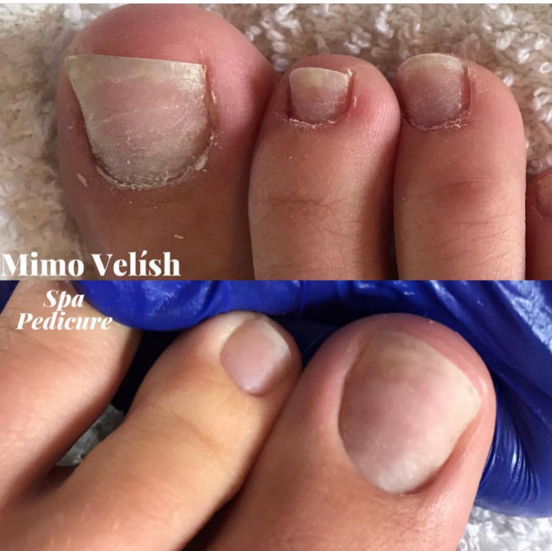 Mimo Velish #beograd Estetski pedikir