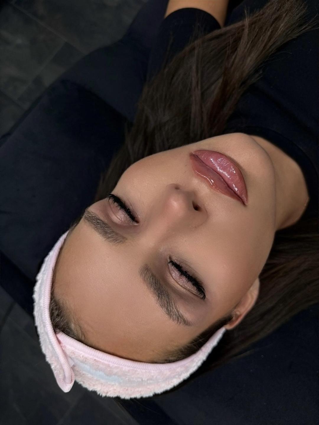 Brow lift - Belle Ana, Beograd Trepavice Lice Trepavice, Beograd, Vračar, Čubura, Crveni krst
