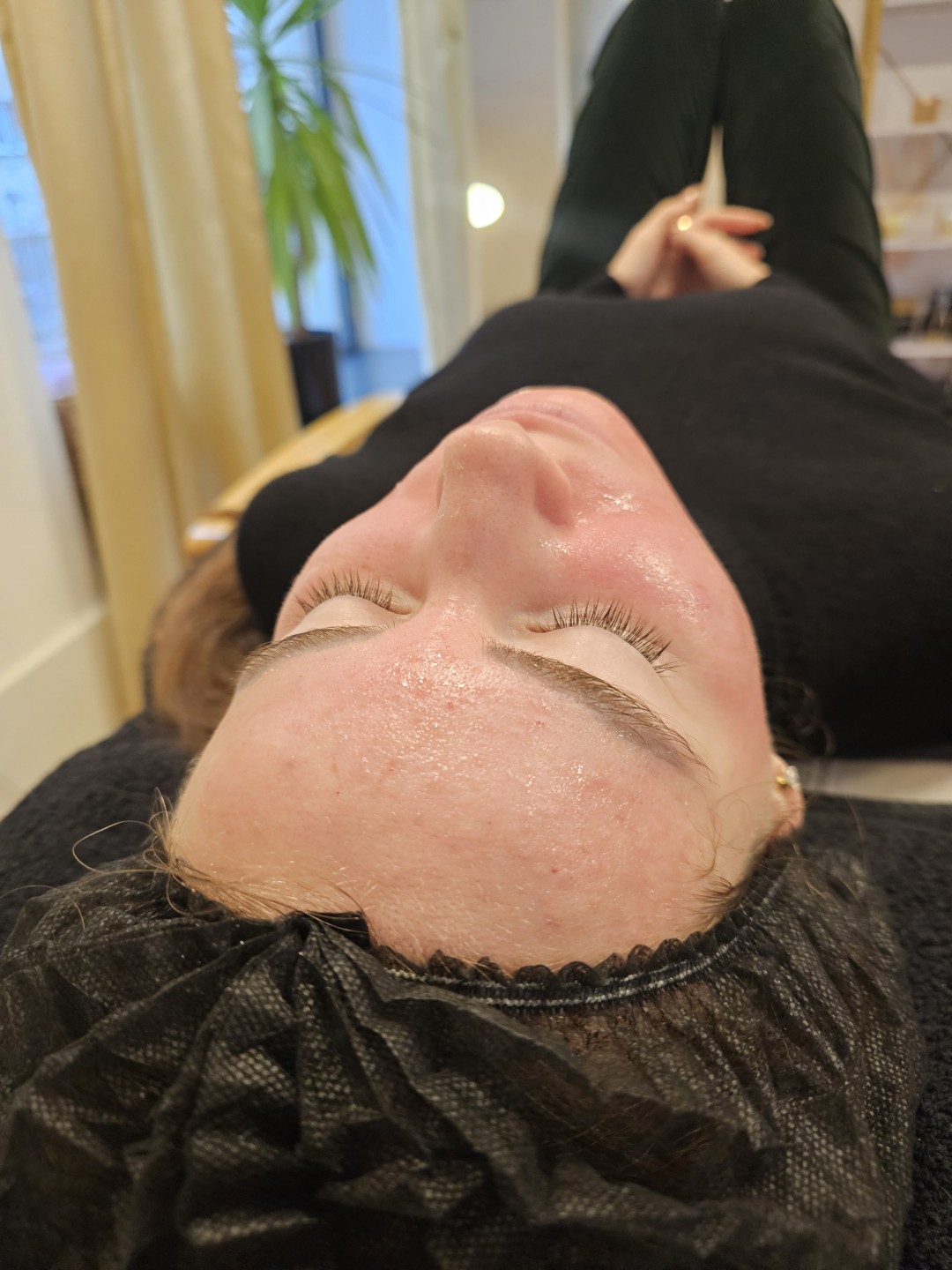 Esthetique Privé #beograd Tretman lica Higijenski tretman lica ( čišćenje lica) + dermapen