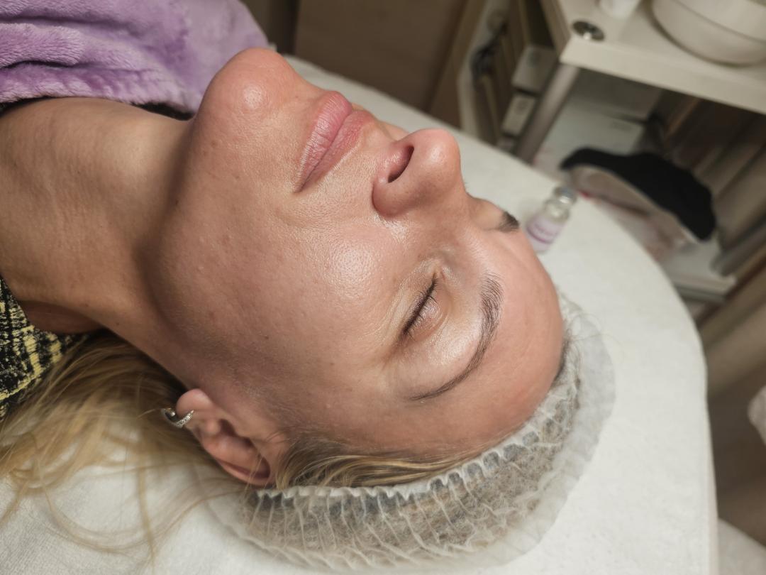 Choco Love #beograd Tretman lica PRX therapy