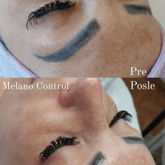 LYS by Royal Beauty Switzerland usluga