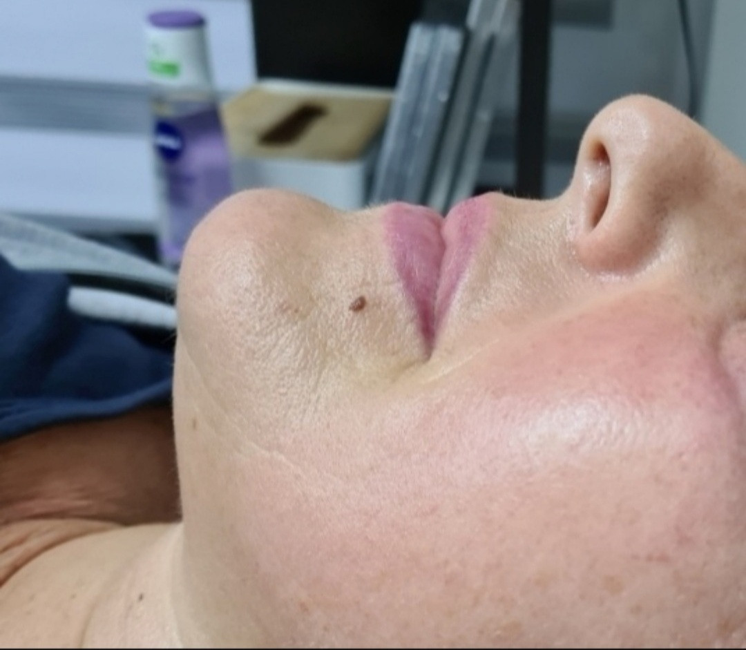 SunBox #beograd Masaža lica Face gym / Face fitness - anti age masaža lica