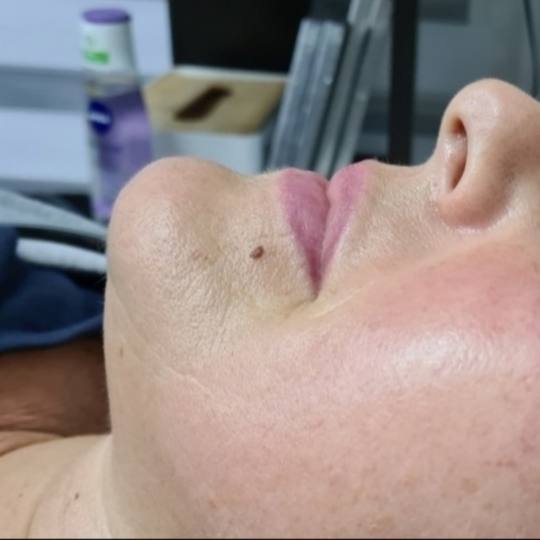 SunBox #beograd Masaža lica Face gym / Face fitness - anti age masaža lica